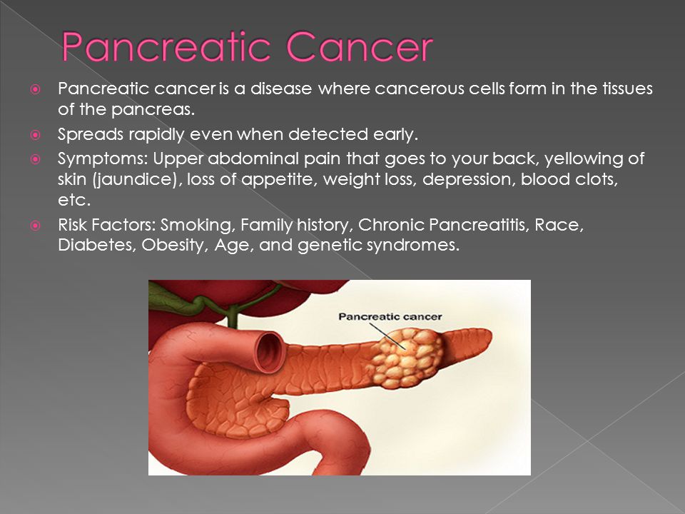 Como prevenir el cáncer de pancreas